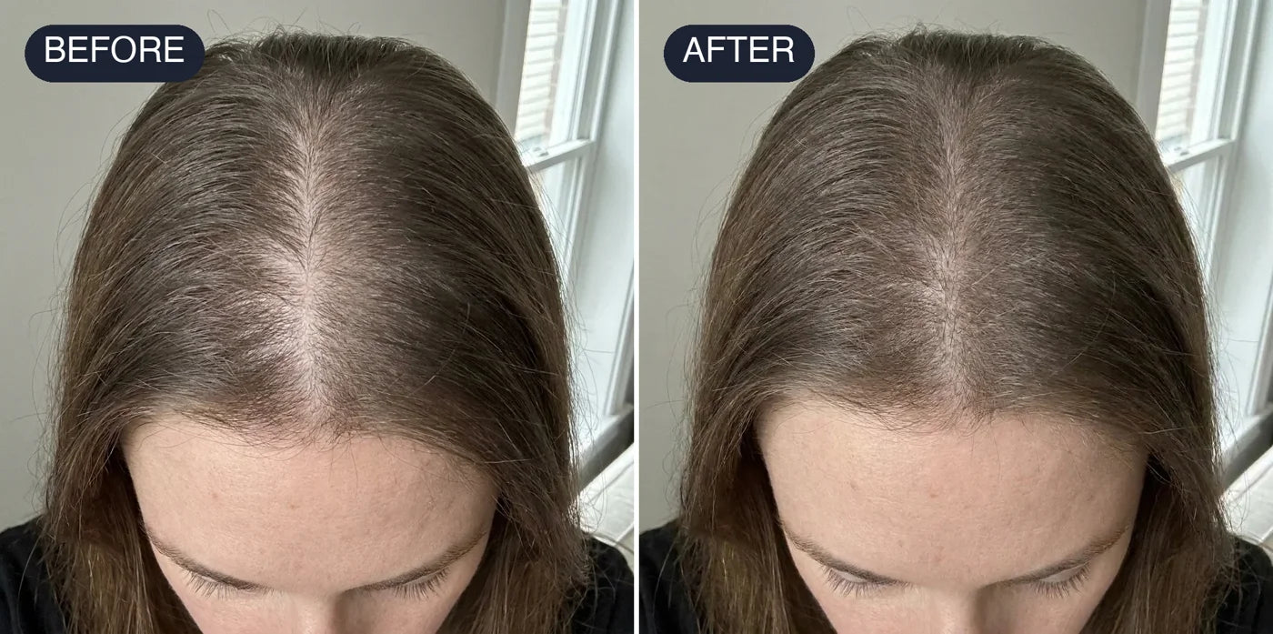 Before and after