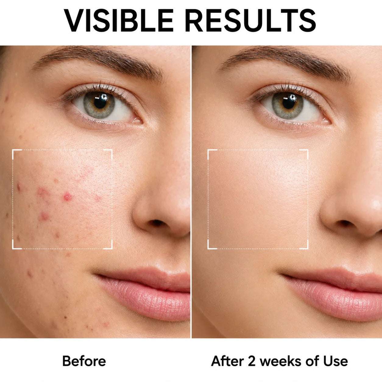 Before and after — face