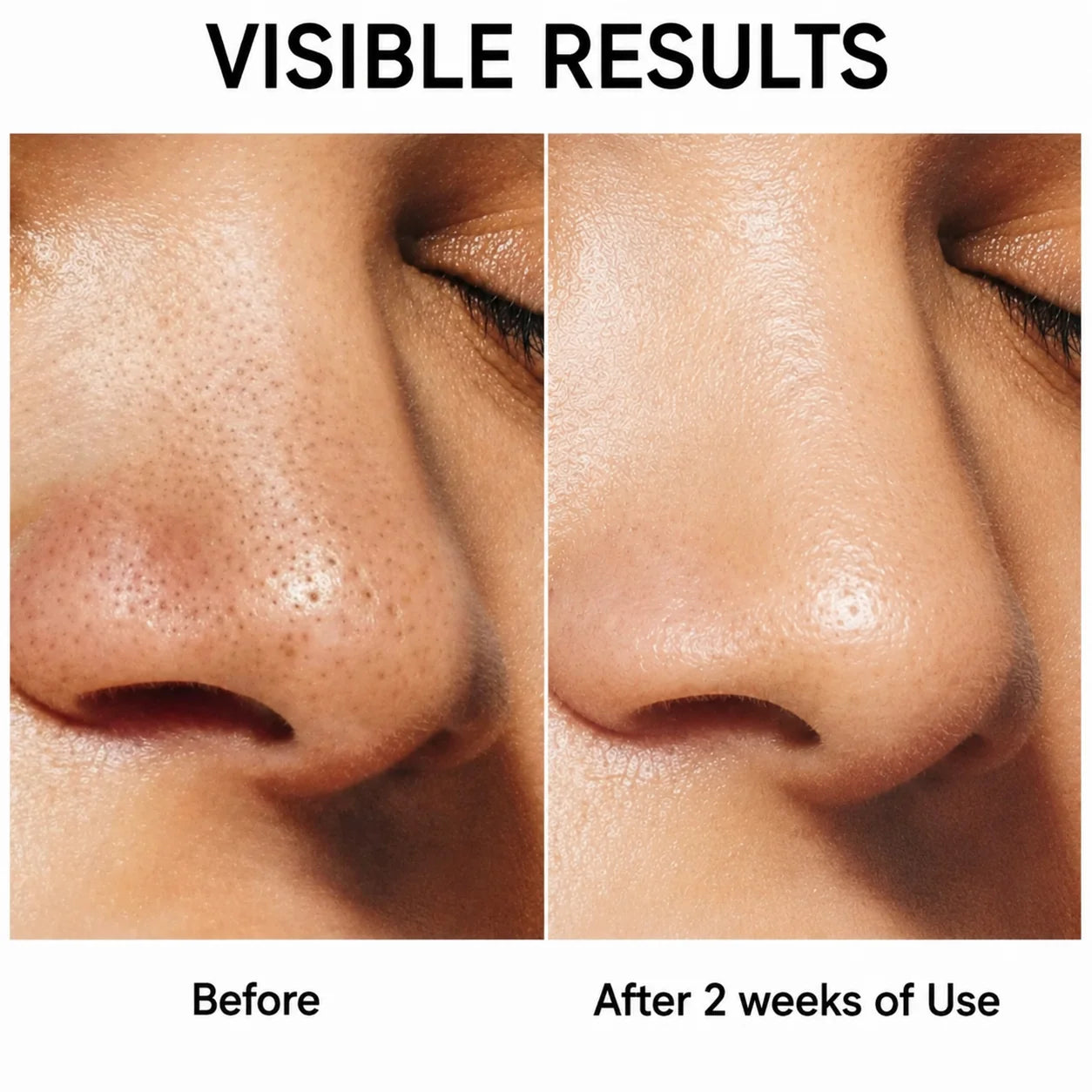 Before and after — nose